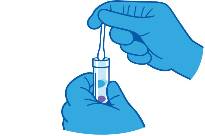 Medical laboratory test tube with blue protective gloves.